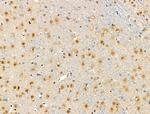 Phospho-53BP1 (Ser1618) Antibody in Immunohistochemistry (Paraffin) (IHC (P))
