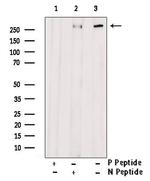 Phospho-53BP1 (Ser1618) Antibody in Western Blot (WB)
