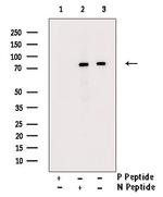 Phospho-SLP76 (Ser376) Antibody in Western Blot (WB)
