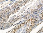 Phospho-SLP76 (Ser376) Antibody in Immunohistochemistry (Paraffin) (IHC (P))