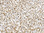 Phospho-BRK (Tyr447) Antibody in Immunohistochemistry (Paraffin) (IHC (P))