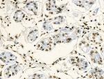 Phospho-GIT2 (Tyr592) Antibody in Immunohistochemistry (Paraffin) (IHC (P))