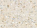Phospho-RSK1 (Thr573) Antibody in Immunohistochemistry (Paraffin) (IHC (P))