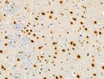 Phospho-RSK1 (Thr573) Antibody in Immunohistochemistry (Paraffin) (IHC (P))