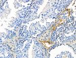 Phospho-CD226 (Ser329) Polyclonal Antibody