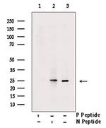 Phospho-MOB4A (Thr12) Polyclonal Antibody