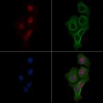 Phospho-DBC1 (Thr454) Polyclonal Antibody