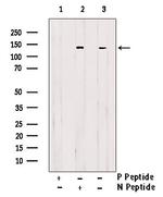Phospho-DBC1 (Thr454) Antibody in Western Blot (WB)