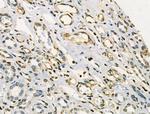 Phospho-CAMKK2 (Ser511) Antibody in Immunohistochemistry (Paraffin) (IHC (P))