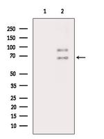 Phospho-CAMKK2 (Ser511) Antibody in Western Blot (WB)
