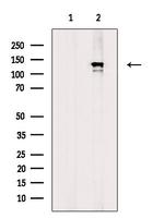 Phospho-CARD11 (Ser652) Antibody in Western Blot (WB)