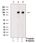 Phospho-CDCP1 (Tyr707) Polyclonal Antibody