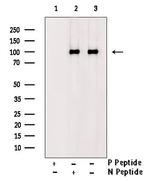Phospho-CDCP1 (Tyr806) Polyclonal Antibody