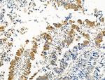 Phospho-RAD18 (Ser403) Polyclonal Antibody