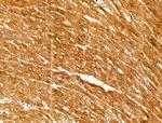 Phospho-PERK (Ser1096) Antibody in Immunohistochemistry (Paraffin) (IHC (P))