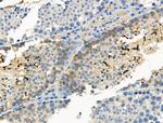 Phospho-ALK (Tyr1096) Polyclonal Antibody