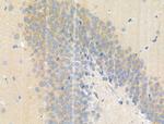 Phospho-ALK (Tyr1096) Antibody in Immunohistochemistry (Paraffin) (IHC (P))