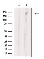 Phospho-ALK (Tyr1096) Antibody in Western Blot (WB)