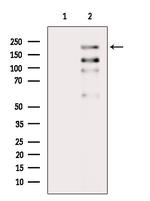 Phospho-ALK (Tyr1096) Antibody in Western Blot (WB)