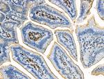 Phospho-ALK (Tyr1282, Tyr1283) Polyclonal Antibody