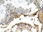 Phospho-ALK (Tyr1282, Tyr1283) Antibody in Immunohistochemistry (Paraffin) (IHC (P))