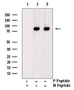 Phospho-ALK (Tyr1282, Tyr1283) Antibody in Western Blot (WB)