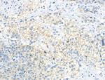 Phospho-DAPP1 (Tyr139) Polyclonal Antibody