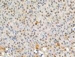 Phospho-ATF6 (Thr166) Antibody in Immunohistochemistry (Paraffin) (IHC (P))