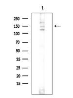 SOS1 Polyclonal Antibody