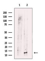 ROC1 Polyclonal Antibody