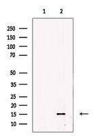 ENSA Polyclonal Antibody