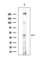 TOB1 Polyclonal Antibody