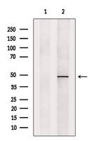 PSMC5 Polyclonal Antibody