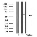 FASTK Antibody in Western Blot (WB)