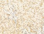 HDAC5 Antibody in Immunohistochemistry (Paraffin) (IHC (P))