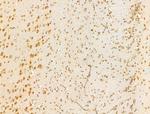 HDAC5 Antibody in Immunohistochemistry (Paraffin) (IHC (P))