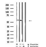 Phospho-LCK (Ser59) Antibody in Western Blot (WB)