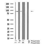 Phospho-ATRIP (Ser224) Polyclonal Antibody