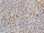 Phospho-MYPT1 (Thr853) Polyclonal Antibody