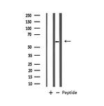 GABRB1 Polyclonal Antibody