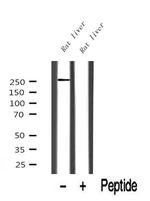 ARHGAP31 Antibody in Western Blot (WB)