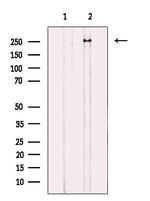 ARHGAP31 Antibody in Western Blot (WB)