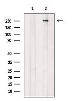 ARHGAP31 Polyclonal Antibody