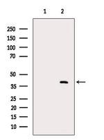 Nudel Polyclonal Antibody
