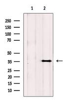 Nudel Antibody in Western Blot (WB)