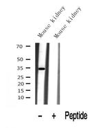 KHK (Isoform A) Antibody in Western Blot (WB)