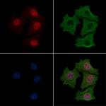 Phospho-CDK20 (Thr161) Polyclonal Antibody