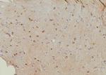 Phospho-KCNH2 (Ser1137) Antibody in Immunohistochemistry (Paraffin) (IHC (P))