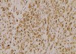 Phospho-HCN1 (Ser846) Polyclonal Antibody