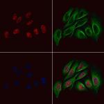 Phospho-KLF5 (Ser303) Polyclonal Antibody